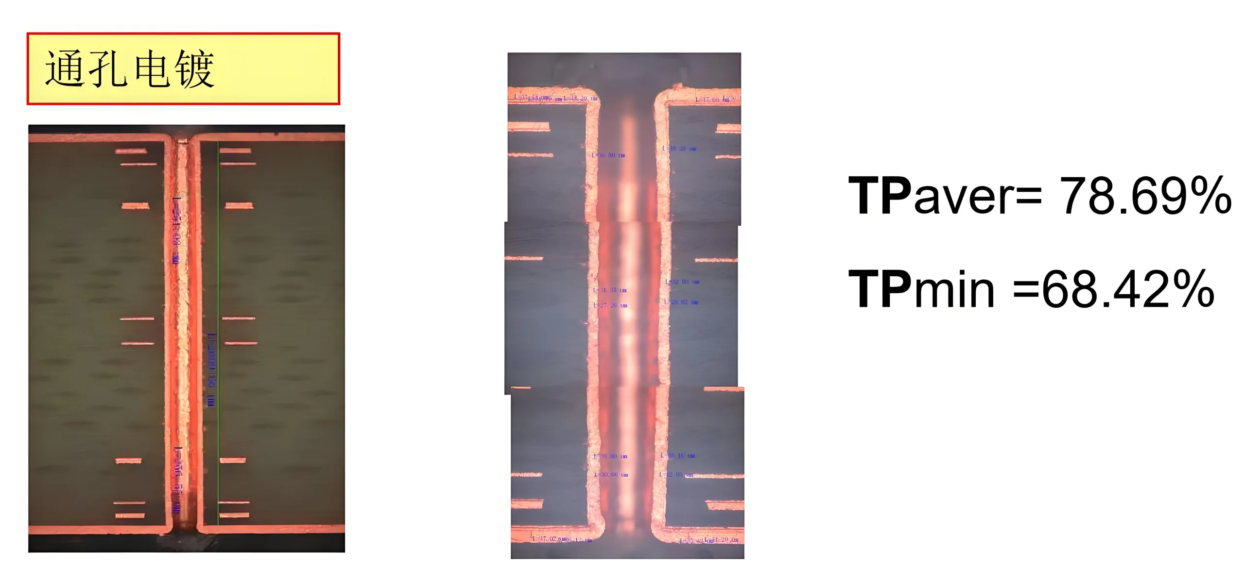 HDI through-hole plating